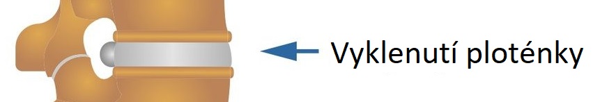 degen_dicsCZ3vyklen 1083